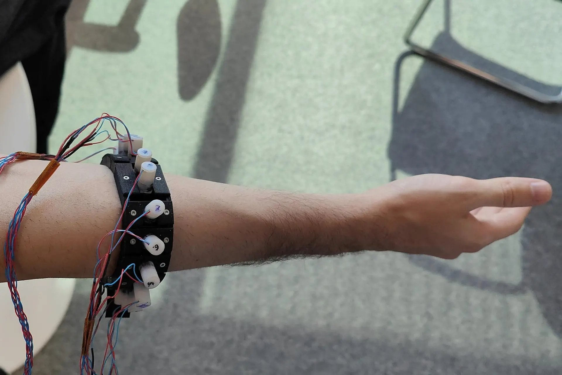 Ultrasound-Powered Prosthetic Hand